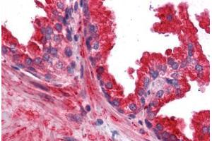 anti-Related RAS Viral (R-Ras) Oncogene Homolog 2 (RRAS2) (AA 1-205) antibody