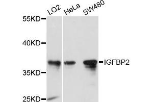 Western blot analysis of extracts of various cell lines, using IGFBP2 antibody. (IGFBP2 抗体)