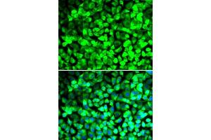 Immunofluorescence analysis of U2OS cells using EIF5 antibody. (EIF5 抗体  (AA 1-235))