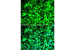 Immunofluorescence analysis of U2OS cells using EIF5 antibody. (EIF5 抗体  (AA 1-235))