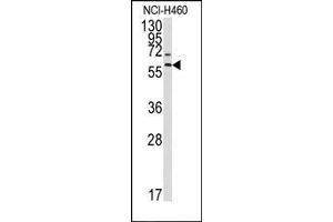 Image no. 1 for anti-Matrix Metallopeptidase 17 (Membrane-inserted) (MMP17) (Middle Region) antibody (ABIN358690) (MMP17 抗体  (Middle Region))
