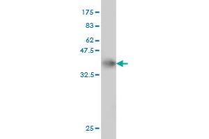 Western Blot detection against Immunogen (36. (TBCK 抗体  (AA 601-700))