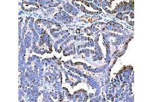 IHC analysis of DPY19L1 using anti-DPY19L1 antibody (ABIN7601445). (DPY19L1 抗体  (AA 354-657))