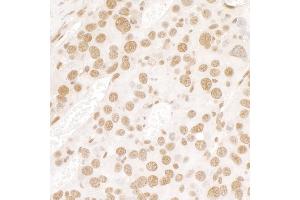 Immunohistochemistry (IHC) image for anti-Fused in Sarcoma (FUS) (AA 1-50) antibody (ABIN7448573) (FUS 抗体  (AA 1-50))