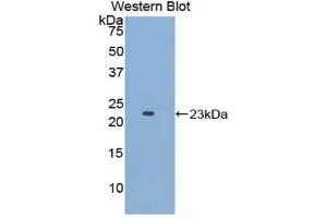 Detection of Recombinant APOE, Human using Polyclonal Antibody to Apolipoprotein E (APOE) (APOE 抗体  (AA 19-181))