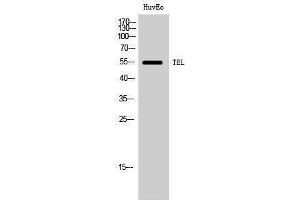 Western Blotting (WB) image for anti-Ets Variant 6 (ETV6) (Ser37) antibody (ABIN3177671) (ETV6 抗体  (Ser37))