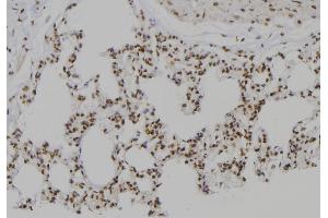 Immunohistochemistry (IHC) image for anti-Proteasome (Prosome, Macropain) 26S Subunit, ATPase, 2 (PSMC2) (Internal Region) antibody (ABIN6264479)