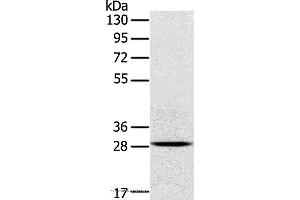 Western blot analysis of Mouse brain tissue, using TREM2 Polyclonal Antibody at dilution of 1:250 (TREM2 抗体)