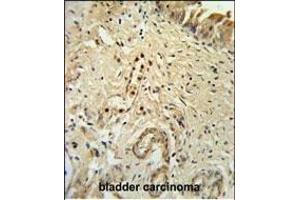 Immunohistochemistry (Paraffin-embedded Sections) (IHC (p)) image for anti-Inhibitor of DNA Binding 4, Dominant Negative Helix-Loop-Helix Protein (ID4) (AA 1-30), (N-Term) antibody (ABIN653935)