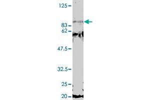 Detection of GCN5 by Western blotting using the GCN5 polyclonal antibody  . (MED17 抗体)