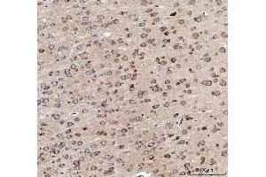 IHC analysis of EEA1 using anti-EEA1 antibody (ABIN5692856). (EEA1 抗体)