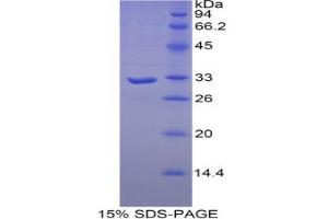 SDS-PAGE analysis of Human Myosin Heavy Chain 16 Protein. (MYH16 蛋白)