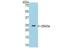 Western blot analysis of recombinant Mouse DSC1. (Desmocollin 1 抗体  (AA 135-340))
