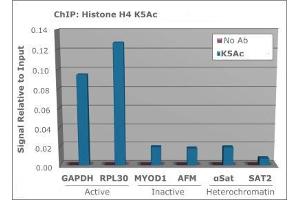 Chromatin Immunoprecipitation (ChIP) image for anti-Histone H4 (acLys5) antibody (ABIN5706799)
