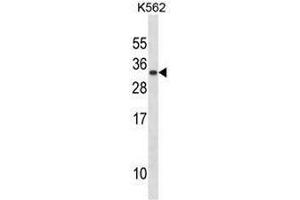 PRL Antibody (C-term) western blot analysis in K562 cell line lysates (35µg/lane). (Prolactin 抗体  (C-Term))