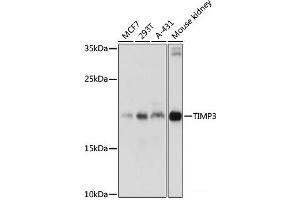 Western blot analysis of extracts of various cell lines using TIMP3 Polyclonal Antibody at dilution of 1:1000. (TIMP3 抗体)