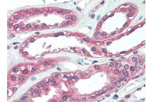 Human Kidney (formalin-fixed, paraffin-embedded) stained with ARHGEF17at 5 µg/ml followed by biotinylated goat anti-rabbit IgG secondary antibody, alkaline phosphatase-streptavidin and chromogen. (ARHGEF17 抗体)