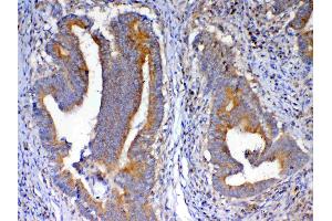 IHC analysis of NSF using anti-NSF antibody . (NSF 抗体  (AA 620-744))