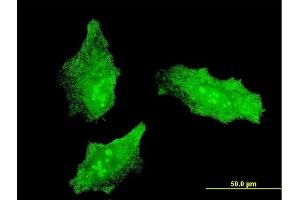 Immunofluorescence of monoclonal antibody to MKI67 on HeLa cell. (Ki-67 抗体  (AA 3157-3256))