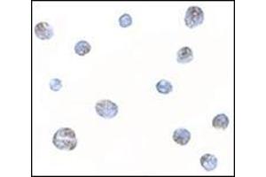 Immunocytochemistry of Norrin in Jurkat cells with this product at 5 μg/ml. (Norrie Disease (Pseudoglioma) 抗体  (N-Term))
