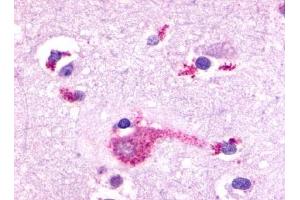 Immunohistochemical staining of Brain (Neurons and glia) using anti- GRM2 antibody ABIN122313 (GRM2 抗体  (N-Term))