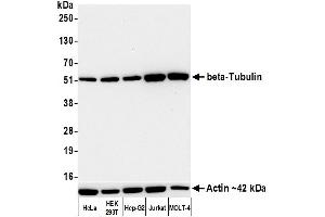 Western Blotting (WB) image for anti-Tubulin, beta (TUBB) (AA 1-50) antibody (ABIN7453995)