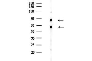 anti-Fibrinogen-Like 2 (FGL2) (C-Term) antibody