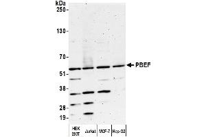 Western Blotting (WB) image for anti-Nicotinamide phosphoribosyltransferase (NAMPT) (AA 400-450) antibody (ABIN7454619) (NAMPT 抗体  (AA 400-450))