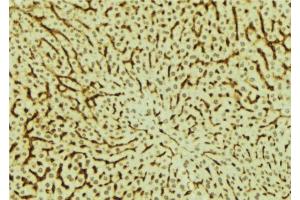 ABIN6279527 at 1/100 staining Mouse liver tissue by IHC-P. (MED28 抗体  (Internal Region))