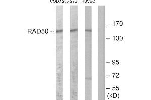 Western Blotting (WB) image for anti-RAD50 Homolog (S. Cerevisiae) (RAD50) (Internal Region) antibody (ABIN1850502) (RAD50 抗体  (Internal Region))