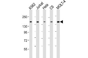 All lanes : Anti-CTCF Antibody at 1:4000 dilution Lane 1: K562 whole cell lysate Lane 2: Jurkat whole cell lysate Lane 3: Hela whole cell lysate Lane 4: C6 whole cell lysate Lane 5: MOLT-4 whole cell lysate Lysates/proteins at 20 μg per lane. (CTCF 抗体  (AA 445-727))