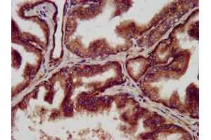 Immunohistochemistry (IHC) image for anti-ClpP Caseinolytic Peptidase, ATP-Dependent, Proteolytic Subunit Homolog (E. Coli) (CLPP) (AA 223-277) antibody (ABIN7144958)