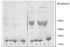 Western Blotting (WB) image for anti-C-Reactive Protein (CRP) antibody (ABIN781723) (CRP 抗体)