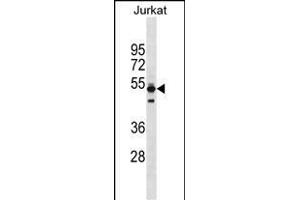 TO Antibody (Center) (ABIN1538173 and ABIN2838131) western blot analysis in Jurkat cell line lysates (35 μg/lane). (Thymopoietin 抗体  (AA 243-269))