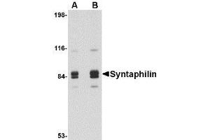 Image no. 1 for anti-Syntaphilin (SNPH) (Internal Region) antibody (ABIN1493822) (Syntaphilin 抗体  (Internal Region))