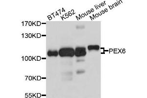 Western blot analysis of extracts of various cell lines, using PEX6 antibody (ABIN5998494) at 1/1000 dilution. (PEX6 抗体)
