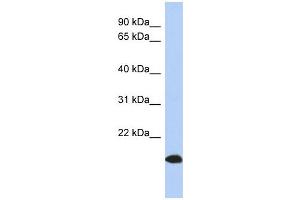 ARL17 antibody used at 1 ug/ml to detect target protein. (ARL17 抗体  (Middle Region))
