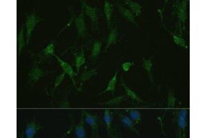 Immunofluorescence analysis of C6 cells using TRPV1 Polyclonal Antibody at dilution of 1:100. (TRPV1 抗体)