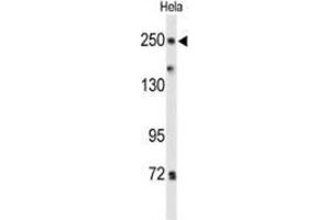 Western blot analysis of PTPRD(arrow) in Hela cell line lysates (35ug/lane) using PTPRD  Antibody  (N-term). (PTPRD 抗体  (N-Term))
