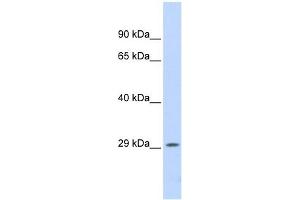 PSME1 antibody used at 1 ug/ml to detect target protein. (PSME1 抗体  (Middle Region))