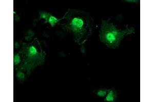 Immunofluorescence (IF) image for anti-Aryl Hydrocarbon Receptor Interacting Protein-Like 1 (AIPL1) antibody (ABIN1496509) (AIPL1 抗体)