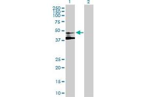 Western Blot analysis of ST3GAL3 expression in transfected 293T cell line by ST3GAL3 MaxPab polyclonal antibody. (ST3GAL3 抗体  (AA 1-390))
