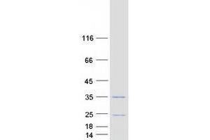 Validation with Western Blot (Spindlin 2B Protein (SPIN2B) (Transcript Variant 1) (Myc-DYKDDDDK Tag))