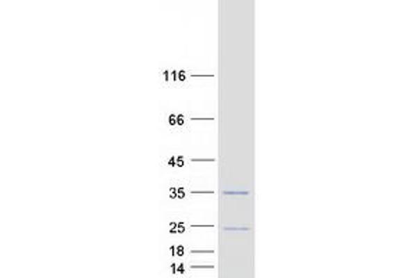 Spindlin 2B Protein (SPIN2B) (Transcript Variant 1) (Myc-DYKDDDDK Tag)