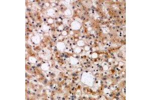 Immunohistochemical analysis of SPFH1 staining in human liver formalin fixed paraffin embedded tissue section. (ERLIN1 抗体)