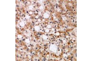 Immunohistochemical analysis of SPFH1 staining in human liver formalin fixed paraffin embedded tissue section. (ERLIN1 抗体)