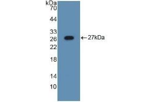 Detection of Recombinant ASGR1, Mouse using Polyclonal Antibody to Asialoglycoprotein Receptor 1 (ASGR1) (Asialoglycoprotein Receptor 1 抗体  (AA 80-281))