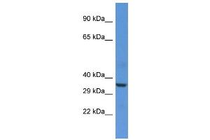 Host:  Rabbit  Target Name:  HMOX1  Sample Type:  Jurkat Whole Cell lysates  Antibody Dilution:  1.