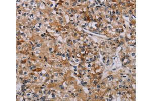 Immunohistochemistry (IHC) image for anti-Apoptosis-Associated tyrosine Kinase (AATK) antibody (ABIN2827106) (AATK 抗体)