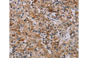 Immunohistochemistry (IHC) image for anti-Apoptosis-Associated tyrosine Kinase (AATK) antibody (ABIN5546867) (AATK 抗体)